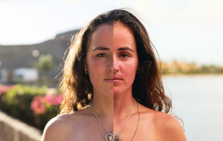 Annasley before and after